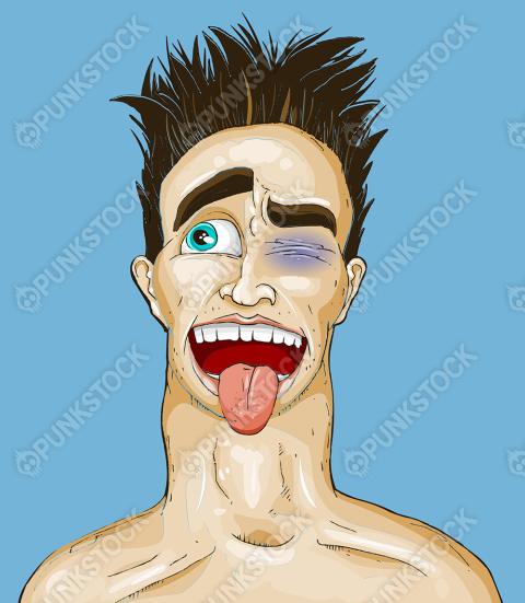 Handsome guy with black eye